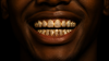 Moissanite Custom Teeth Grillz